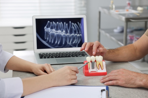 Should I Be Concerned About A Black Line Around My Dental Crown?