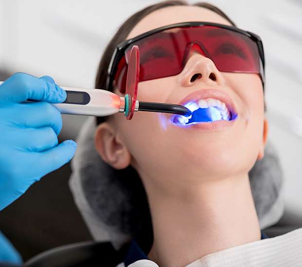 Missouri City Professional Teeth Whitening